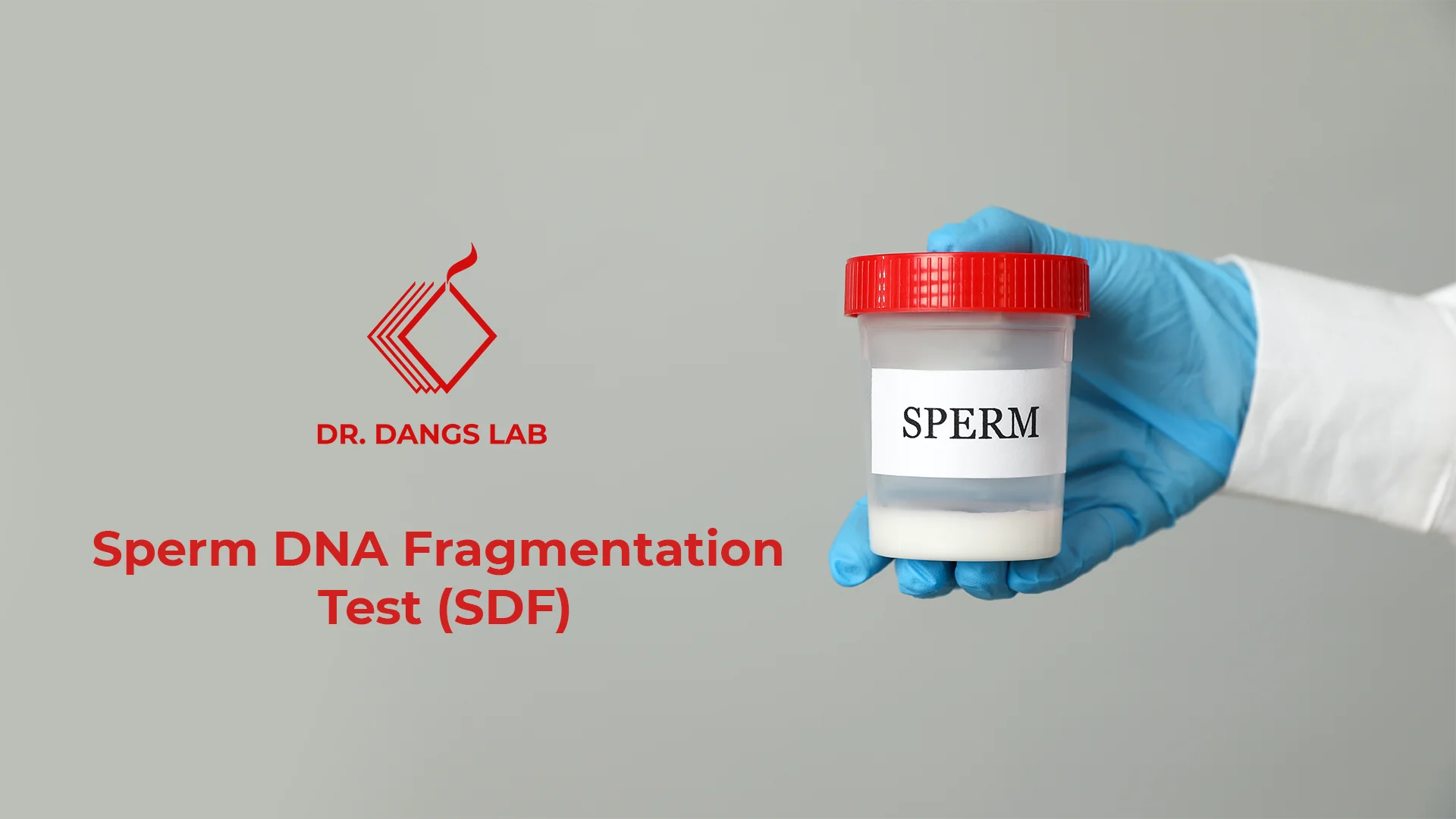 Sperm DNA Fragmentation Test (SDF) in Delhi | Advanced Semen Analysis ...